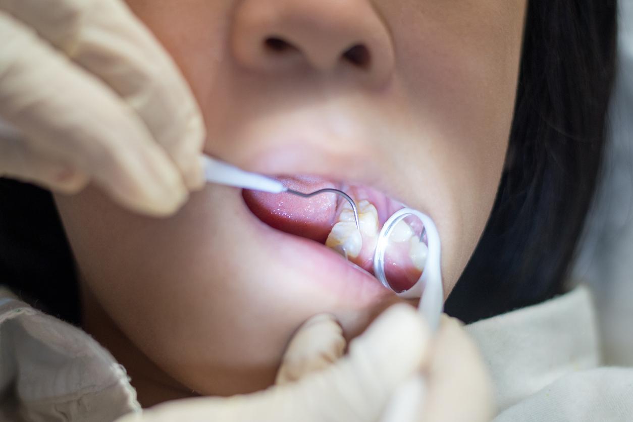 Dentist examines young girl's back teeth