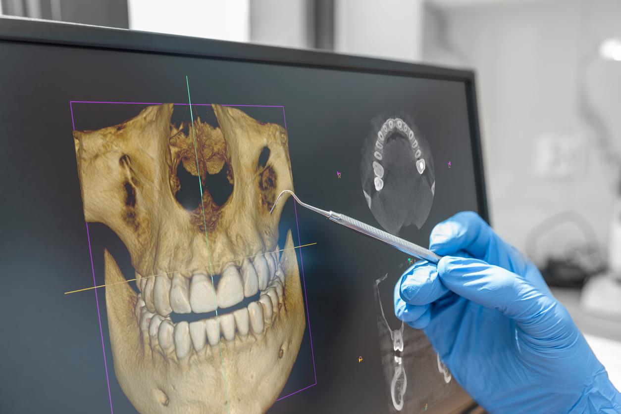 Dentist reviews detailed image of patient's mouth